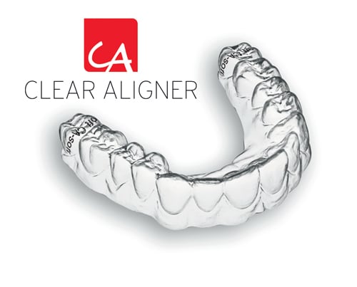 Clear Aligner Invisalign unsichtbare Schiene